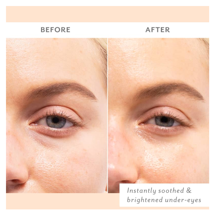 Skin Remedy Soothing Eye Gels - Single